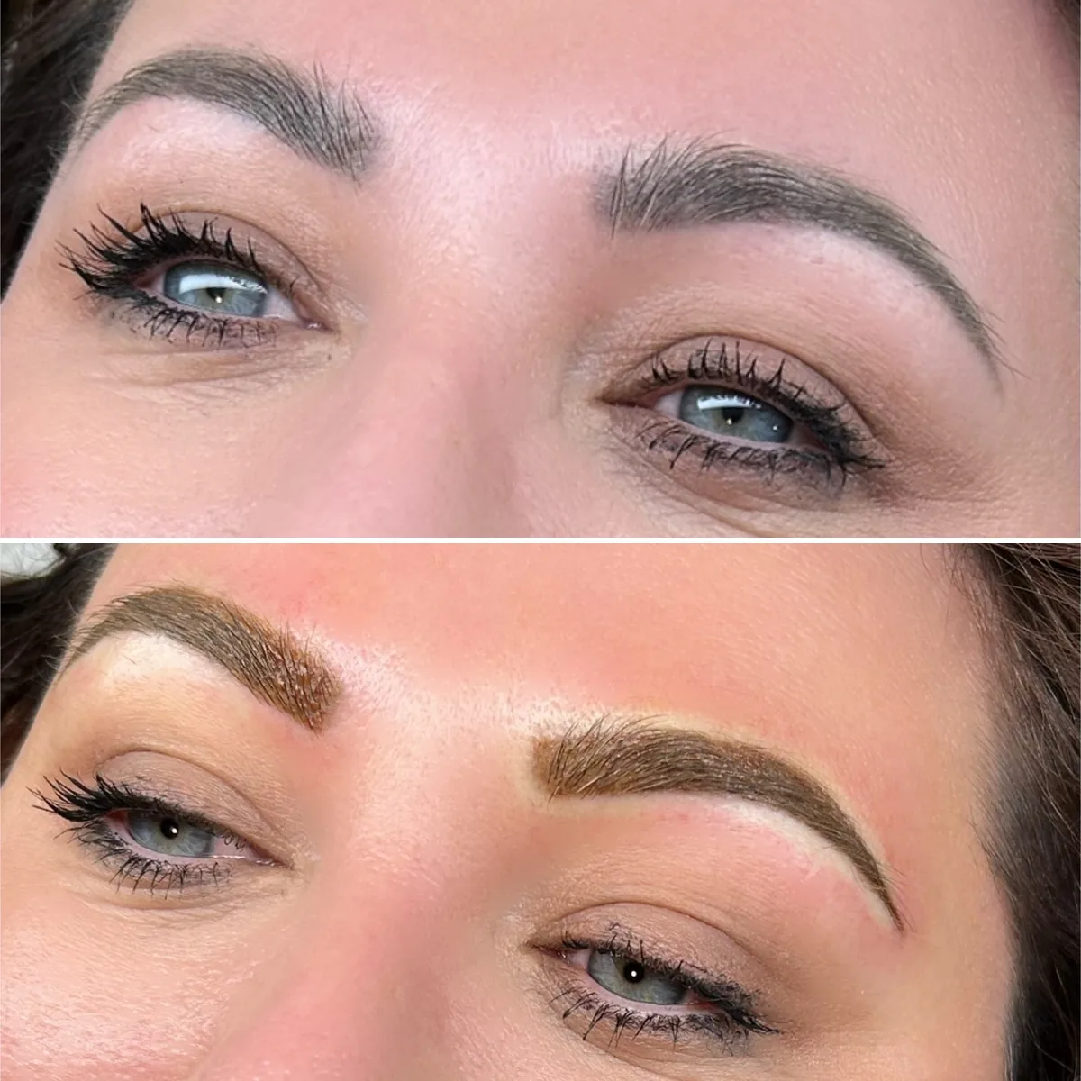 brow correction before and after