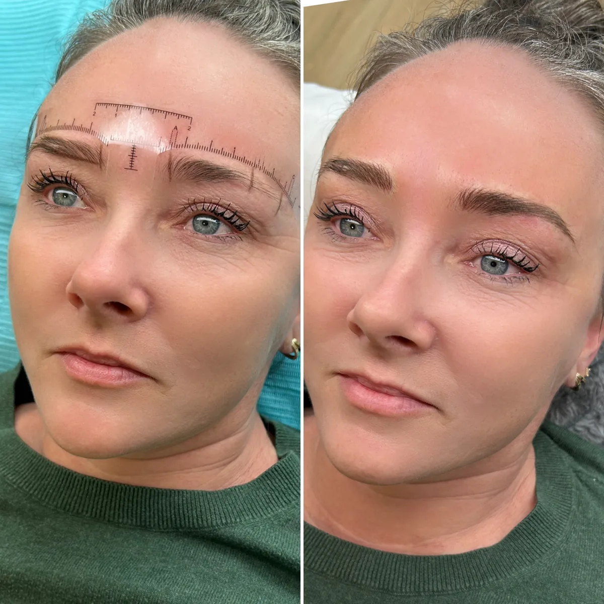 brow mapping before and after