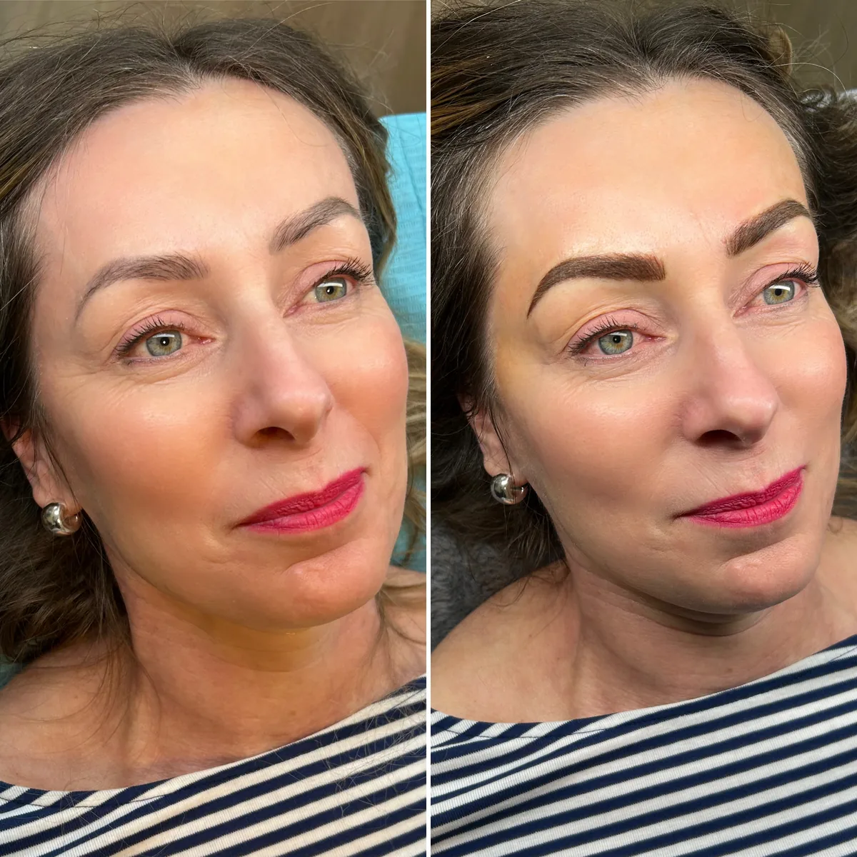 A gloved hand refreshing a healed brow at a touch-up